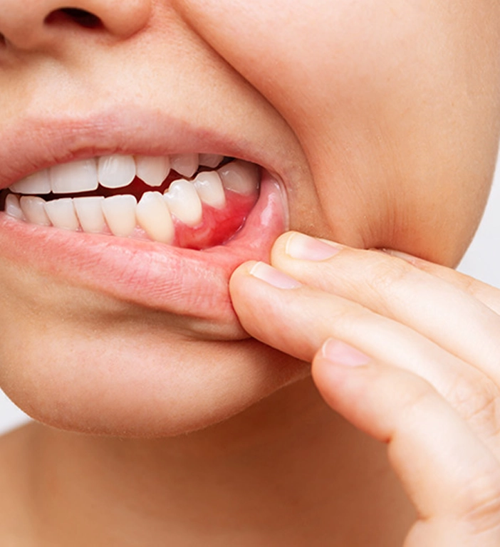 Tractament ràpid del dolor dental per una dentista d’urgència a la clínica SDS dentista a Vilafranca