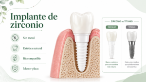 implante dental de zirconio circonio Vilafranca del Penedes