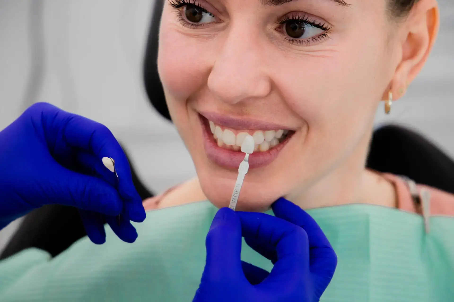 Paciente comparando el tono dental antes del tratamiento de blanqueamiento en SDS Dental Clinic, Vilafranca del Penedès