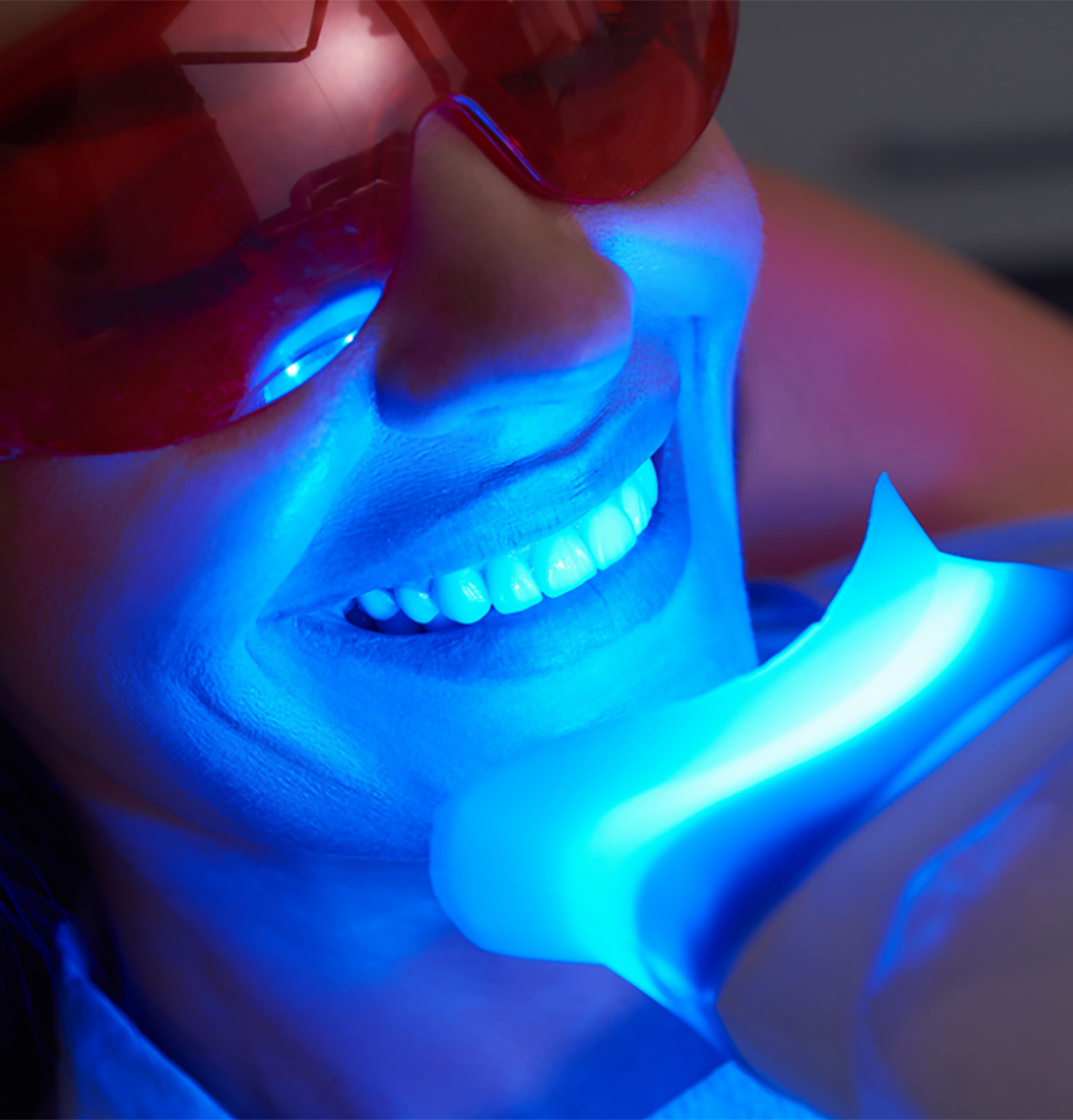 Paciente recibiendo blanqueamiento dental con lampara LED en SDS Dental Clinic, dentista Vilafranca