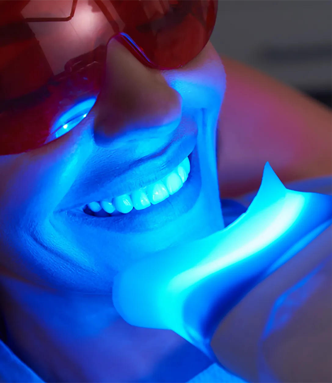 Paciente recibiendo blanqueamiento dental con láser en SDS Dental Clinic, dentista Vilafranca