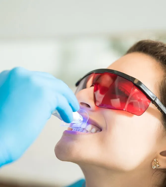 Sesión de blanquejament dental amb làser en Vilafranca del Penedès