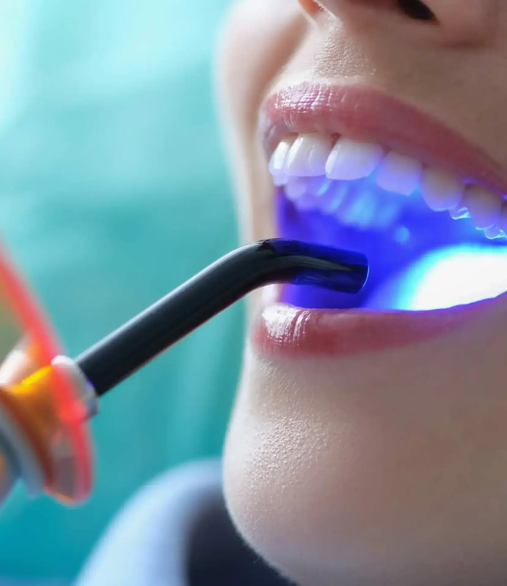 como realitzem l’emblanquiment dental a la nostra clínica de Vilafranca del Penedès