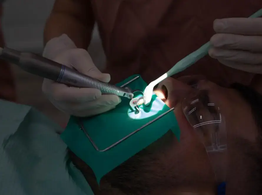 tratamiento de endodoncia en Vilafranca del Penedés, tratamiento con digue en SDS Dental Clinic