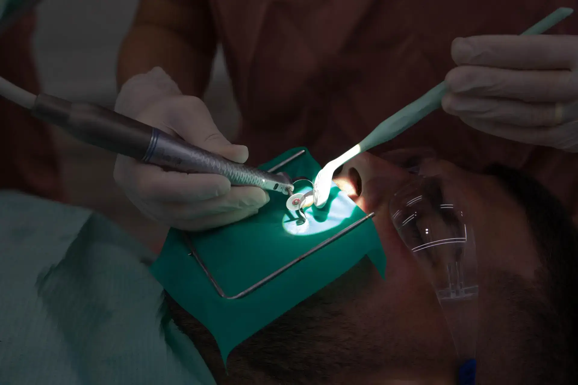 endodoncia Vilafranca, tratamiento con digue en SDS Dental Clinic
