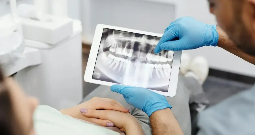 slow1 Odontología Slow en nuestra clinica dental en Vilafranca, imagen de una radiografia OPG